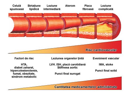 ateroscleroza proces evolutie