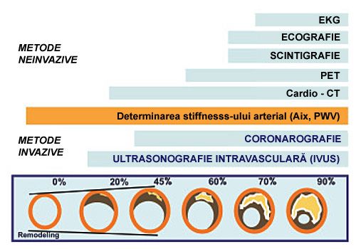 metode neinvazive determinare ateroscleroza
