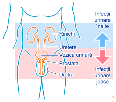 infecție urinară simptome