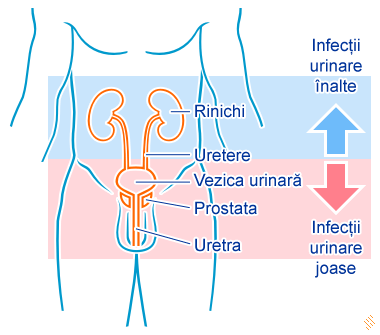 infectie vezica urinara simptome)