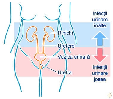 Hematuria (urinare cu sange)