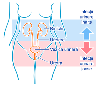 sange la urinare)