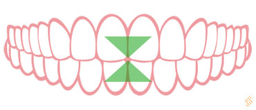 Dentitie normala