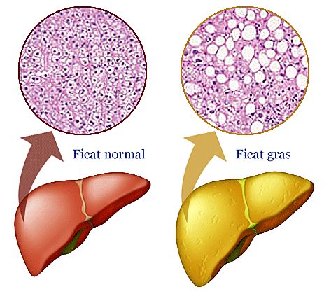 hpv virus russian