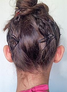 Otoplastie - inainte de interventie