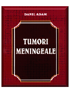 Tumori meningeale