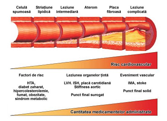 ateroscleroza proces evolutie