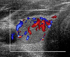 Examinare Doppler color