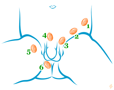 Testicul necoborat - criptorhidia