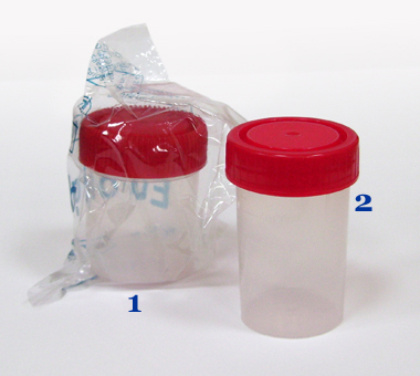recoltarea urinei pentru proba cu trei pahare