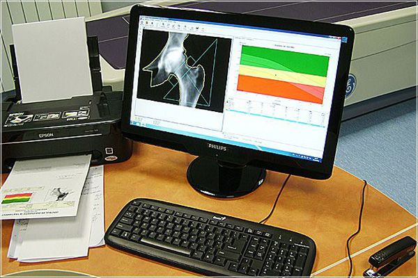 Osteodensitometry test electronic result
