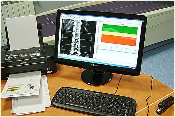 Osteodensitometry test electronic result