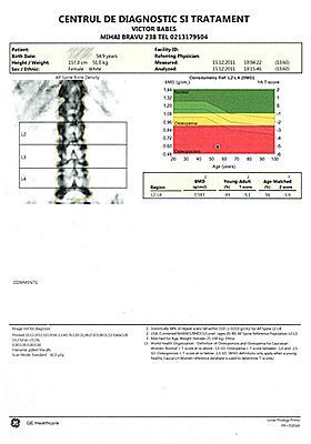 Examen osteodensitometrie coloana - rezultat tiparit