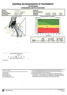 Hip osteodensitometry examination - printed result