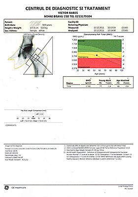 Examen osteodensitometrie sold - rezultat tiparit